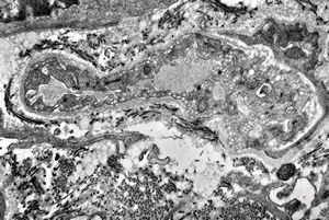duodenum … lipid malabsorption duodenum … lipid malabsorption